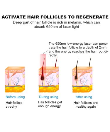 Buy Aimanfun 180pcs Laser Hair Growth Devices for Men & Women Boost Hair Growth & Thickness - Buy Online on GoSupps.com