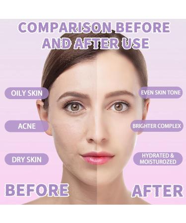 Jelly Mask Set - Professional Hyaluronic Acid & Rose Hydro Jelly Face Masks | Moisturizing DIY Mask Kit with Mixing Bowl & Headband - Perfect Gift - Buy Online on GoSupps.com