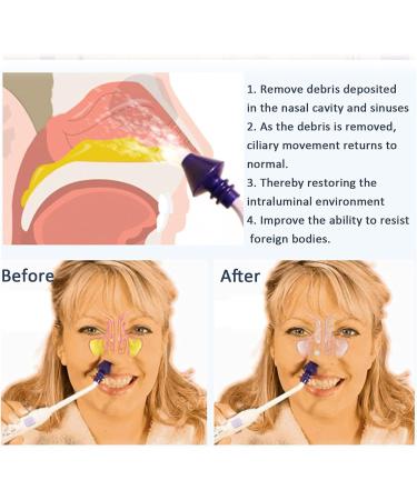 Portable Nasal Irrigator 7 Modes Nose Cleaner fitug Pulsating Nasal Wash Irrigation System Sinus Rinse Kit for Adults Child - Buy Online on GoSupps.com