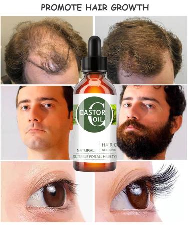 EONFAVE Organic Castor Oil - Hair Growth Oil - Castor Oil Cold Pressed to Strengthen Nourish Hair - Eyelash Growth Essential Oil - Improve Hair Loss and Nourishes Scalp - Buy Online on GoSupps.com