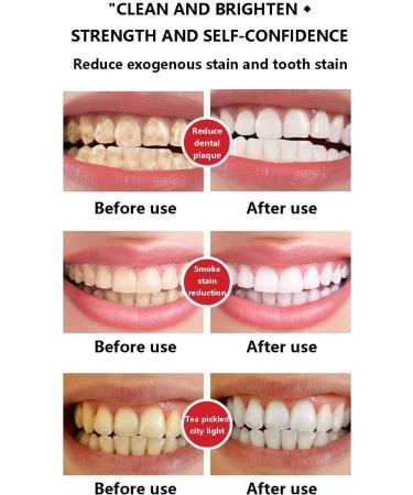 SP-6 Ultra Whitening Probiotic Toothpaste - Brightening & Effective Tooth Care for a Radiant Smile - Buy Online on GoSupps.com