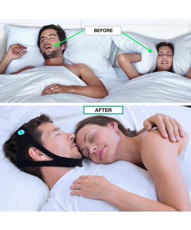 Anti Snoring Chin Strap for Medium/Large Heads - Stop Snoring, Sleep Aid for Mouth Breathers - Men & Women - Buy Online on GoSupps.com