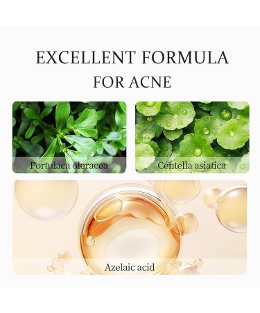 Azelaic Acid Acne Cream for Face Azelaic Acid With Hyaluronic Acids for Face Redness Smooth Anti Acne Breakouts Azelaic Acid Serum Balance Excess Oil & Soothing No Irritation - Buy Online on GoSupps.com