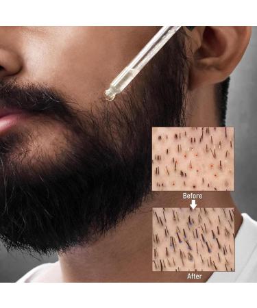 Best Bart Growth Oil for Men | Hair & Beard Growth Essence | Mustache & Face Hair Care - Aibyks 1 fl oz - Buy Online on GoSupps.com