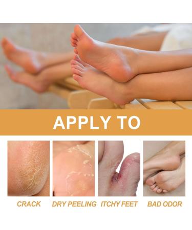 Tongyend Foot Peeling Spray Instant Foot Peeling Spray Foot Callus Removal Spray Moisturizing Hydrating Nourish Peel off Spray Foot Exfoliating Spray Remove Foot Dead Skin-30ML FootCallusRemover - Buy Online on GoSupps.com