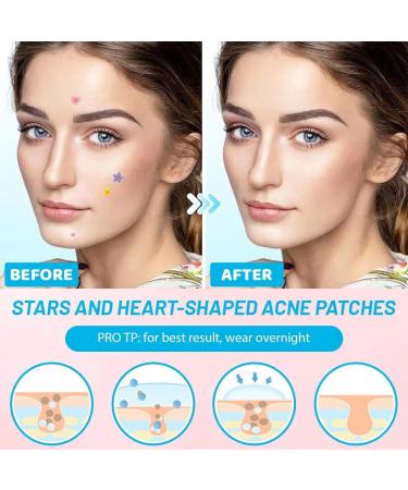 JYNXOR Pimple Patch Star patches pimples stars invisible natural hydrocolloid pimples with tea tree oil salicylic acid acne patch day and night - Buy Online on GoSupps.com