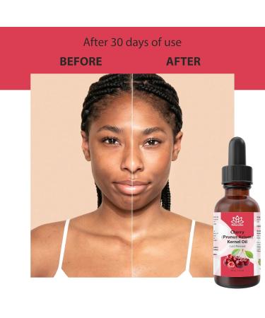 Relaxcation Cherry Kernel Oil Cold Pressed & Unrefined Natural Carrier Oil for Face Hair Scalp Nails & Body Lightweight Non-Greasy and Vegan Travel Size Bottle for Daily Care (1 oz) 1 Fl Oz (Pack of 1) - Buy Online on GoSupps.com