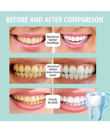 Jorondy Herbal Teeth Mouthwash Foam Brightening & Repairing Oral Care (2PCs) | Solve All Oral Problems - Buy Online on GoSupps.com