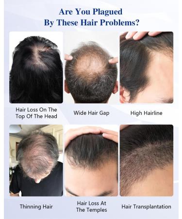 KTS Laser Hair Growth Cap FDA Red Light Therapy Helmet - Anti Hair Loss Treatment for Men & Women - Restores Hair Thickness and Density - Buy Online on GoSupps.com