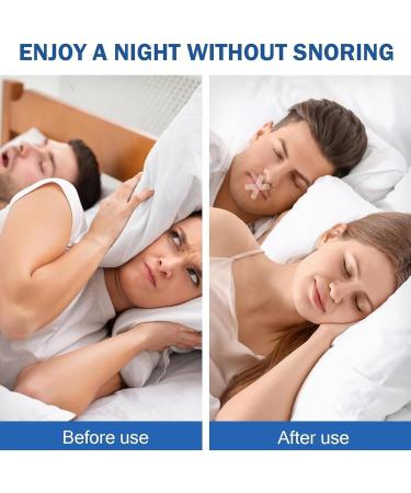 180Pcs Sleep Strips Mouth Tape for Mouth Breathing Prevention - Buy Online on GoSupps.com