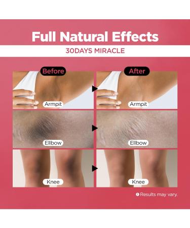 FARMSKIN Dark Spot Corrector Cream - Niacinamide & Vitamin C for Face & Body | 30 Days Miracle Solution for Underarms Knees Elbows & Sensitive Areas (50ml - Buy Online on GoSupps.com