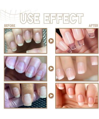 Cracked Nail Repair - Fingernail Repair Clear Nail Gel 5g Strengthening - Natural Fingernail Accessories Nail Repair For Women Girls Nail Strengthener Tytlyworth - Buy Online on GoSupps.com