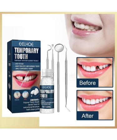 5-Pack Temporary Tooth Repair Kit with Mouth Mirror Family Use at Home - Multi-Colored | International Shipping - Buy Online on GoSupps.com