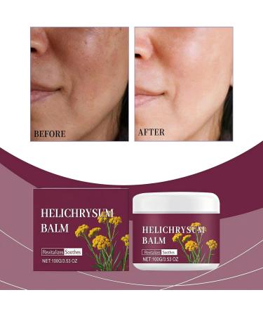 LANGSTON Restorative Body Balm for Crepey Skin and Fragile Thin Skin Firming Moisturizer for Elasticity and Vitality Fast Absorbing Daily Skincare 3.53 Oz 1can 1 Fl Oz (Pack of 1) - Buy Online on GoSupps.com