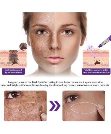 JIAOY EPIGLOW Advanced Pigmentation Cream Tone Correction Moisturizer EPIGLOW Pigmentation Treatment Cream AntiAging Face Removes Dark Spots Skin Buildup 6 Pack 6 Pack - Buy Online on GoSupps.com