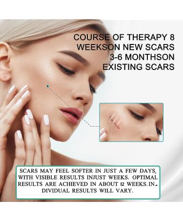 Silicone Scar Sheets Tape for Surgical Scars Removal - Safe for Pregnancy - 1.6x120 Inch - 5-8 Month Supply - Buy Online on GoSupps.com