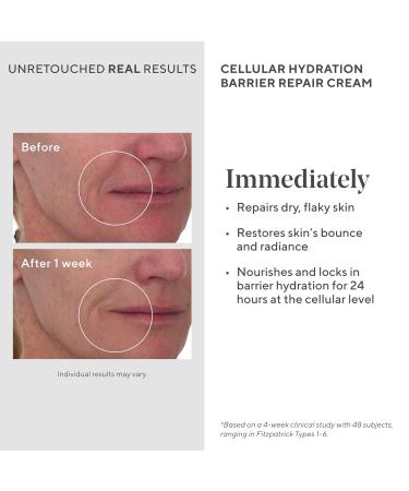 Murad Cellular Hydration Barrier Repair Cream | Nourishing Face Moisturizer for Dry Skin | Bilberry Omega Fatty Acids & Allantoin | 1.7 Fl Oz - Buy Online on GoSupps.com