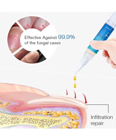 Stylo Huile pour Ongles | Huile fortifiante pour la pousse des ongles - Stylo hydratant | pour Adultes Femmes Personnes g es Maison Voyage Salon - Buy Online on GoSupps.com