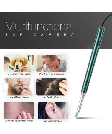 Ear Wax Removal Tool Kit | 1080P HD Ear Camera Endoscope with 6 LED Lights | Ear Scope & Wax Cleaner for Kids and Adults | Compatible with Android, Mac, Windows | Includes 5 Replaceable Ear Spoons (Green) - Buy Online on GoSupps.com