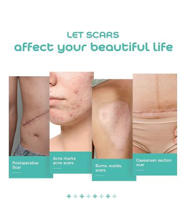 Medical Grade Silicone Tape for Scar Removal - 1'' X 70'' Roll with 5cm Crease, Keloid & Bump Treatment - Easy Tear, Scissor-free - 1 Count - Buy Online on GoSupps.com