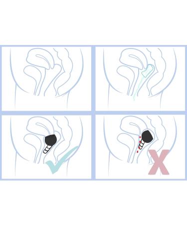 Merula Cup Midnight - Black Medical Silicone Menstrual Cup | One Size | Eco-Friendly & Comfortable - Buy Online on GoSupps.com