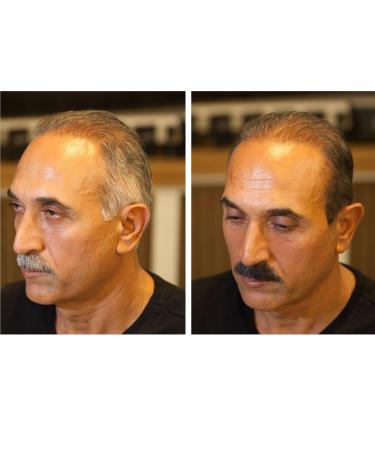 Fixwhite Root Touch Up - Instant Gray Coverage for Hair Mustache & Beard - 20 ML | Black/Dark Brown | For Men & Women - Buy Online on GoSupps.com