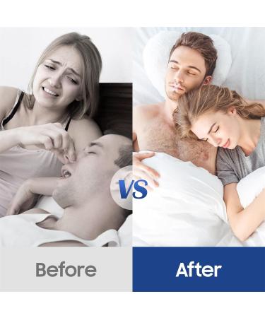 Sleep Strips Mouth Tape - 120 Count for Quality Sleep, Nose Breathing & Snoring Relief - Buy Online on GoSupps.com