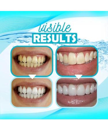 Deep Cleaning Foam Toothpaste - Whitening & Intensive Stain Removal | 60ml Teeth Whitening Solution - Buy Online on GoSupps.com