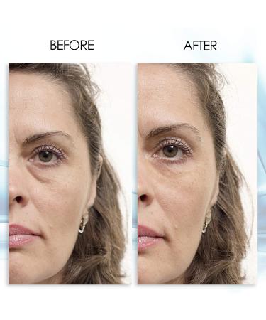 Puffy Eye Gel - Rapid Reduction of Wrinkles, Puffiness, and Bags | Aqua Mineral Hydrating Eye Gel with Green Tea Extract - 1 oz - Buy Online on GoSupps.com