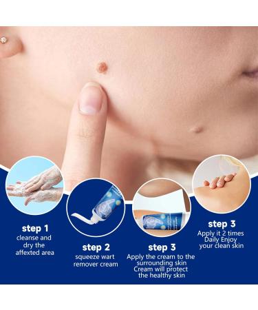  MagiSel Resistant Warts for Hands & Feet Anti-Wart and Anti-Stain Cream Anti-Wart Moisturizing Cream Anti-Corn Foot Descaling Wart Remover for Hands and Feet 20g - Buy Online on GoSupps.com