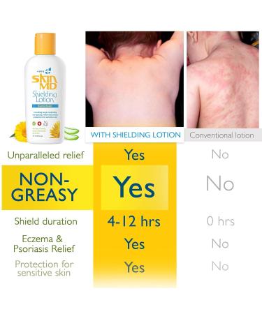 Skin MD Shielding Lotion 4oz + SPF 15 - Eczema & Psoriasis Relief for Face Body & Hands | Best Dry Skin Remedy - Buy Online on GoSupps.com