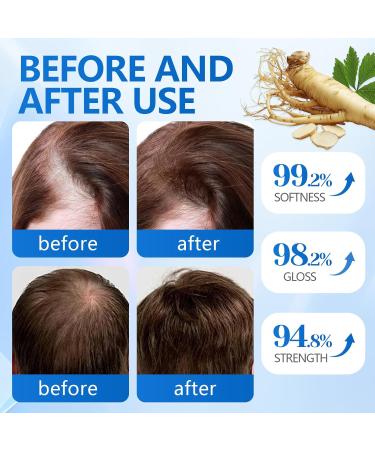 Waymaytecy 60 ml hair growth serum stimulates hair growth stimulates hair growth strengthens the scalp hair care for men and women - Buy Online on GoSupps.com