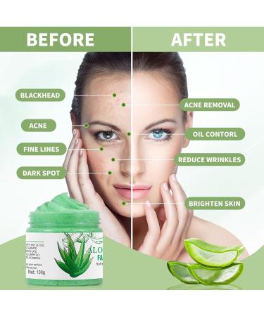 Brightening Aloe Vera Facial Scrub - Exfoliating Face Wash for Blackheads & Dark Spots | Deep Cleansing Exfoliator - Buy Online on GoSupps.com