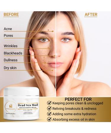 Dead Sea Mud Mask for Face & Body - Natural Acne & Blackhead Treatment - Moisturizing Skincare for Men & Women - 7.05 oz - Made in Jordan - Buy Online on GoSupps.com