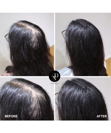 LDN Professional - Hair Fibers Hair Loss Concealer Densificateur de cheveux Cheveux fins et clairsem s Zone de calvitie-effet visible imm diat - 22g (Marron Clair) - Buy Online on GoSupps.com