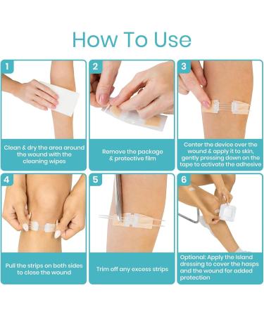 Buy ViveCare Emergency Wound Closure Device Kit 4 Pcs Adhesive Zip Stitch Sutures & Sterile Bandaids for Outdoors | Laceration Closure Without Stitches - Buy Online on GoSupps.com