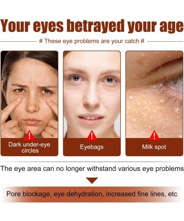 Milia Removal Eye Creams Milia Spots Removal Eye Cream Milia Remover Firming Anti Wrinkle Whitening Eye Cream Smooth Milia Eyes Cream Milia Spot Care Cream 15g - Buy Online on GoSupps.com