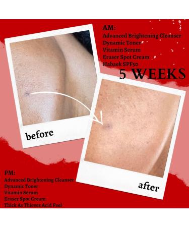 Shop Gymsegb Eraser Cream - 1 oz for Flawless Skin | International Shipping Available - Buy Online on GoSupps.com