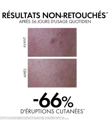 Vichy Capital Soleil UV Clear Fluide Anti-Imperfections Visage SPF50+ Corrige & Prot ge Enrichi en Acide Salicylique Probiotiques et Niacinamide Pour Peaux Mixtes Grasses 40 ml Capital Soleil UV Clear Fluide Anti-Imperfections Visage 40 ml (Lot de 1) - Buy Online on GoSupps.com