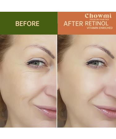 Retinol Anti-Wrinkle Facial Serum Concentrate - Improve Elasticity Tone & Minimize Fine Lines - Age-Defying Formula for Youthful Skin - Buy Online on GoSupps.com