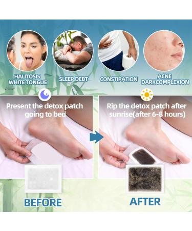 Foot Pads(30 PCS) Deep Cleansing Foot Patches with Premium Herbal Ingredients Patches Supports Restful Sleep & Helps Remove Tension Comfortable Adhesive & No Trace - Buy Online on GoSupps.com