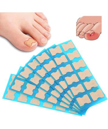 Ingrown Toenail Correction 72 pieces Ingrown Toenail Bandage Sticker Patch Brace Ingrown Toenail Paronychia Corrector Breathable Strips Foot Care Pedicure Straightener Band Toenail Repair Tool - Buy Online on GoSupps.com