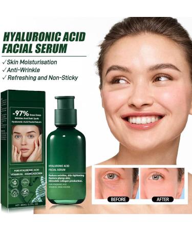 Useful Skin Firming Rejuvenating Serum Useful Skin Firming Serum Hyaluronic Acid Serum for Face Anti Aging Serum for Woman Anti Wrinkle Facial Serum Lifting and Firming Serum Face Tightening Serum - Buy Online on GoSupps.com