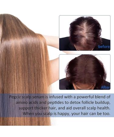 Pegciz Scalp Serum Revitalizer with Argan Oil, Biotin, Caffeine, Stem Cell, Catalase & DHT Blockers - For All Hair Types, Men & Women - Buy Online on GoSupps.com