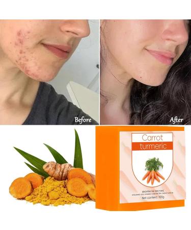 Turmeric Soap Bar for Dark Spots & Acne Relief | Body & Face Cleansing with Vitamin A & Carrot Extract - Shop Now - Buy Online on GoSupps.com