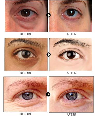 TBeautfave Under Eye Patches Collagen 24K Gold Under Eye Masks for Puffy Eyes & Dark Circles Eye Bags Remover Anti Wrinkle Patches Skincare Anti-aging Hydrating Eye Gel 30 Pairs - Buy Online on GoSupps.com