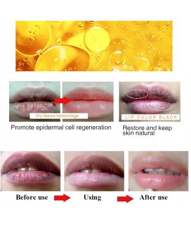 Lip Lightening for Dark Lips Lip Balm Set Lip Balm Lips Pink Bleaching Cream Balm Moisturizing Lip Balm Whitening & Brightening Lip Balm Stick Remove Dark Lips Lip Care for Dry Lips Lip Repair Balm - Buy Online on GoSupps.com