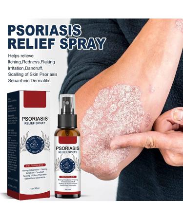 GFOUK Natural Eczema Therapy Spray All Natural Eczema Treatment Psoriasis Treatment Vitiligo Skin Repair Spray Skin Care Pain & Itch Spray Fast Acting Itch Relief (2 Pcs) - Buy Online on GoSupps.com