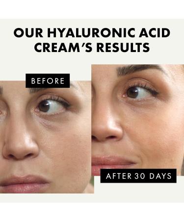Eclat Skincare Hyaluronic Acid Face Cream Hyaluronic Acid with Retinol, Vitamin C & E oisturizer, Hyaluronic Acid - 1.7 Fl Oz - Buy Online on GoSupps.com