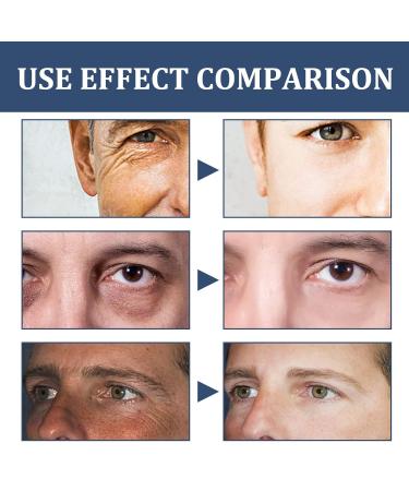 Men's Face Cream - 6-in-1 Facial Care & Eye Bag Treatment | Aesthetic Science for Men Daily Formula for Healthy Skin - Buy Online on GoSupps.com